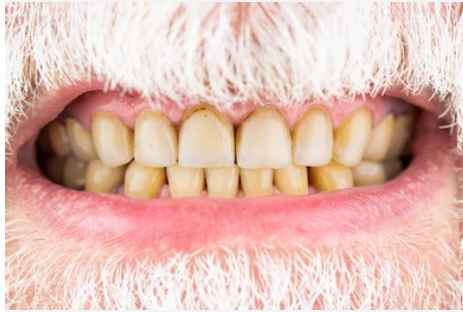 Before – Professional Cleaning